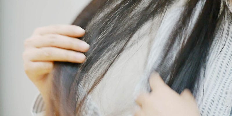 겨울철 찌릿 이제그만!! 머리카락 정전기 예방법 글 대표 이미지